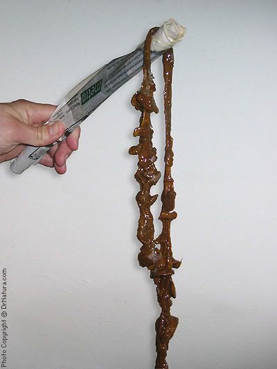 colon_cleanse_lg100.jpg picture by ChrisMat14